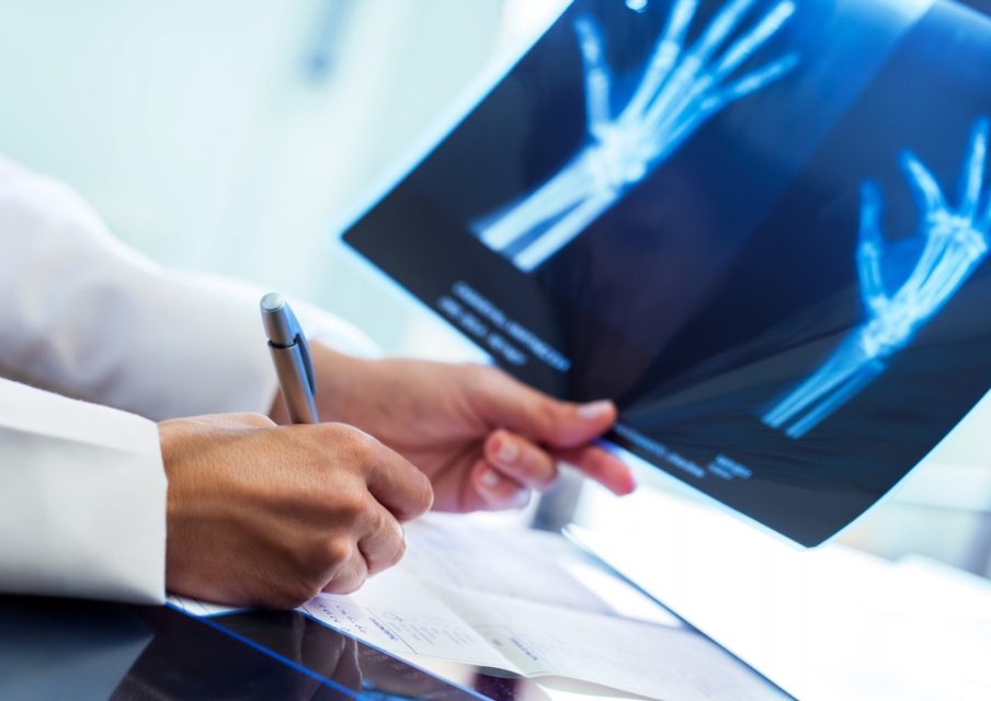 Etudes de médecine : « un étudiant avec une très bonne mémoire a plus de chance de réussir »